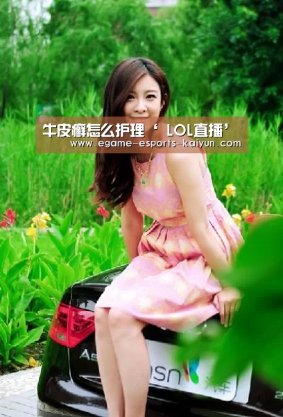 牛皮癣怎么护理‘ LOL直播’